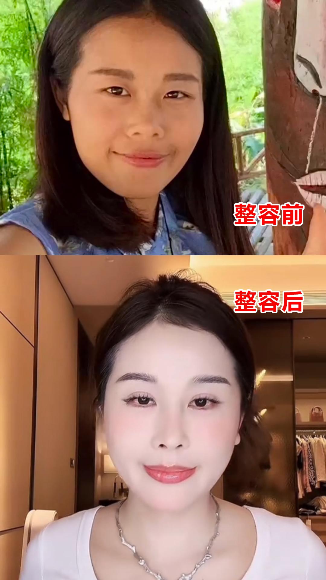 95后网红不自信，
生完3个孩子后，
频繁整容只为留住老公，

95后网红宋玉希