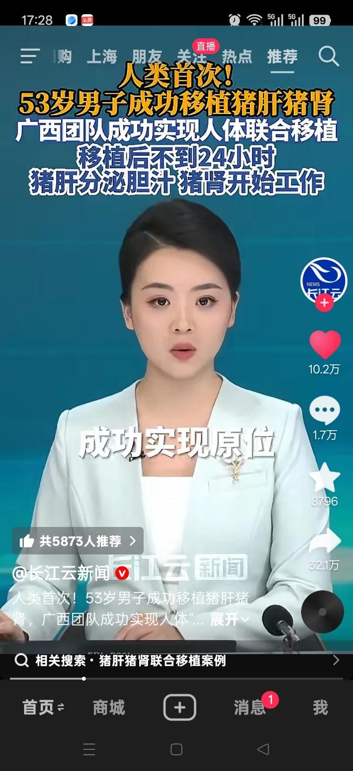 53岁男子成功移植猪肝猪肾，这可真是医学史上的大好事！我国广西医疗团队完成了全球