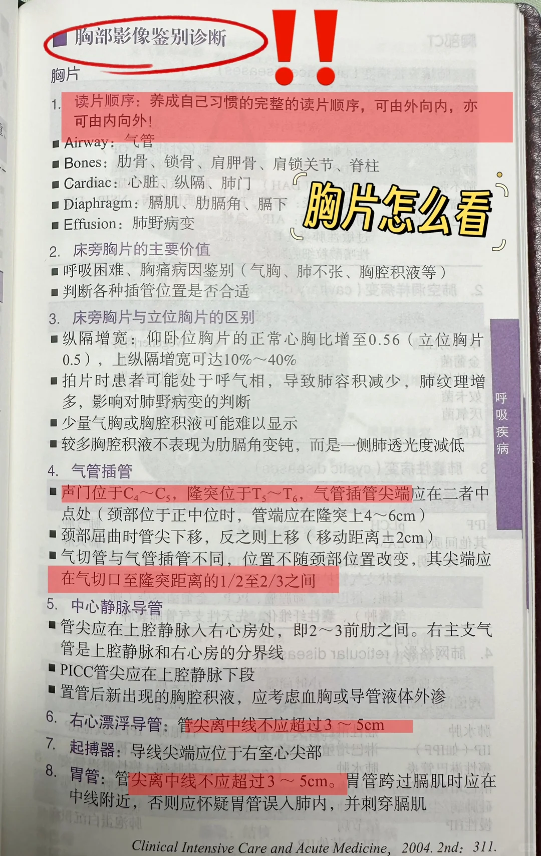 值班遇到胸片怎么看