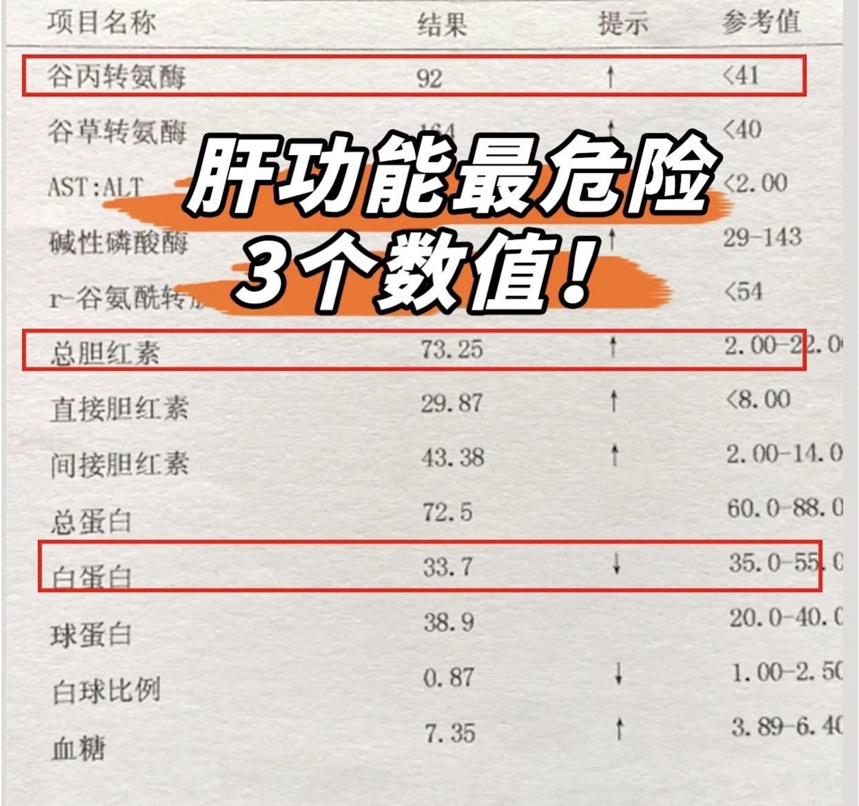 肝功能最危险的3个数值，看你占了没有？ 1、肝脏炎症指标＞谷丙转氨酶和谷草转氨酶：升高说明有肝细胞坏死，数值越高损伤越重，超过80身体会出现乏力，120-140为中度升高，200-400重度升高，会出现乏力，头晕，恶心，腹胀，呕吐，严重会引发肝衰竭（常见升高原因：乙肝，肝硬化，肝癌等）。 
2、胆汁分泌及排泄指标→三项胆红素
黄疸，数值越高黄疸越重，需及时排查原因（常见有肝细胞性黄疸，急性肝炎，慢性肝炎，肝硬化，溶血性黄疸等）。 
3、肝脏合成指标 白蛋白，不低于35，当过低会造成水肿，腹水，低蛋白血症，需