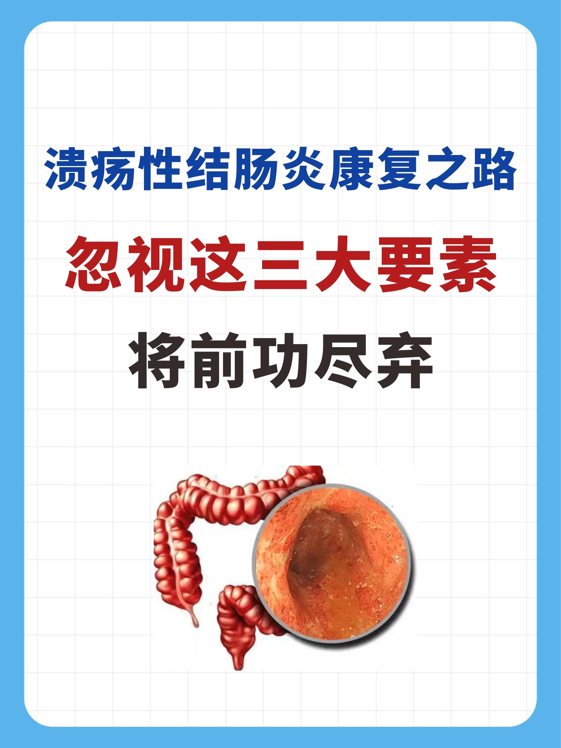 溃疡性结肠炎不能忽视的三大要素。