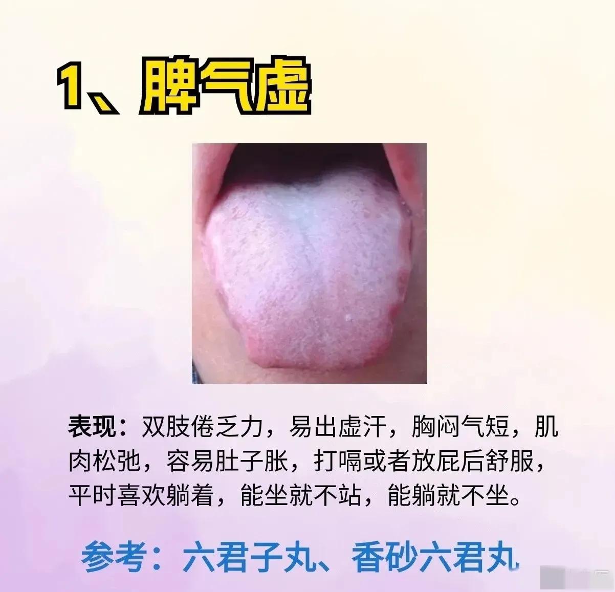 你是否经常感到疲倦无力、食欲不振？这可能是脾虚在作祟！脾虚有七个发展阶段，今天就