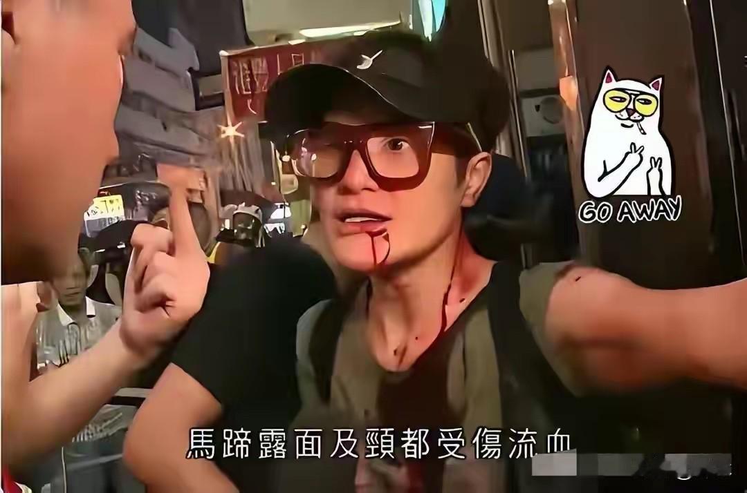 有些人和有些事不能被忘记：2019年，马蹄露正面和暴徒硬刚，支持爱国者被打得头破