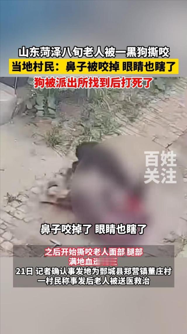 惨不忍睹！山东一老太太路过一户人家的时候，被突然窜出的大黑狗绊倒在地，谁曾想，大