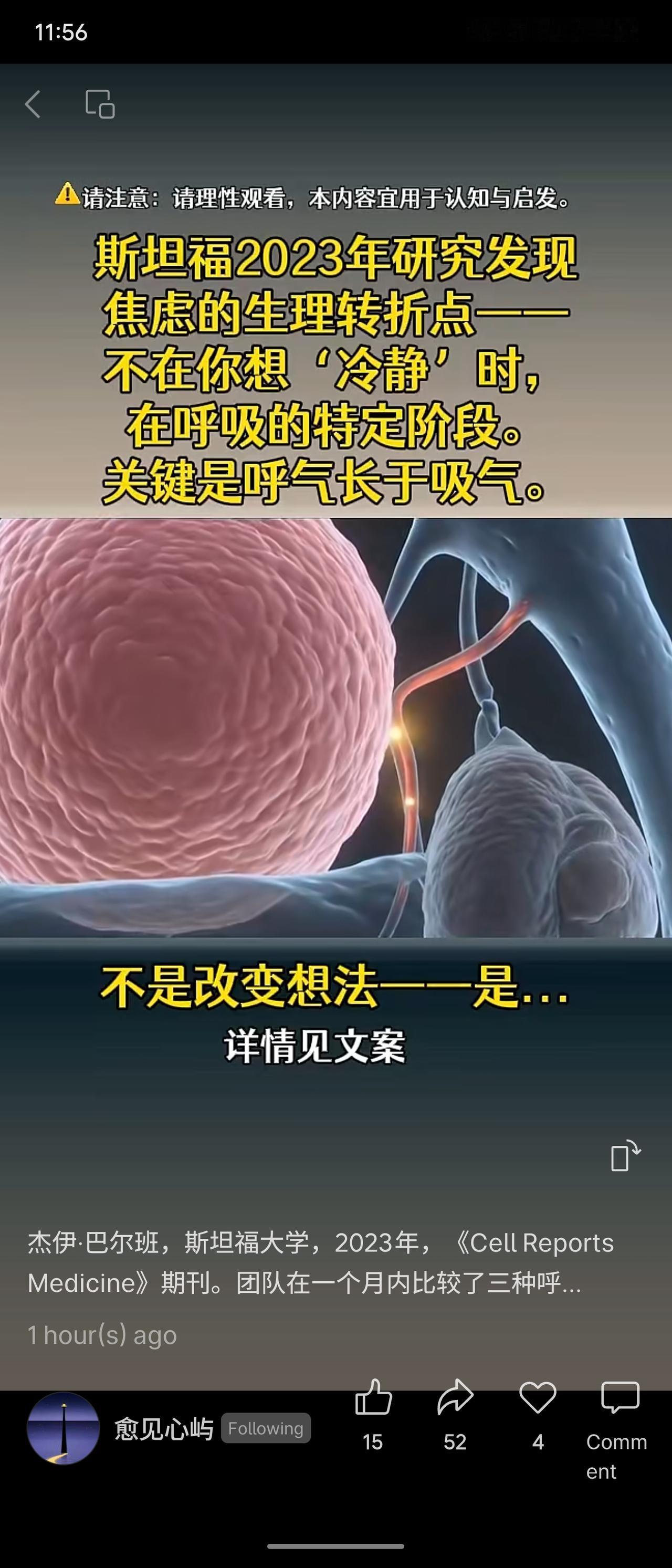 拓展说明
斯坦福大学2023年发表于《Cell Reports Medicine