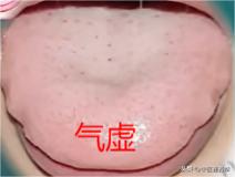 三虚不同房，同房命不长！快来对照一下你占了几个，千万不要大意
1.气虚不同房
表