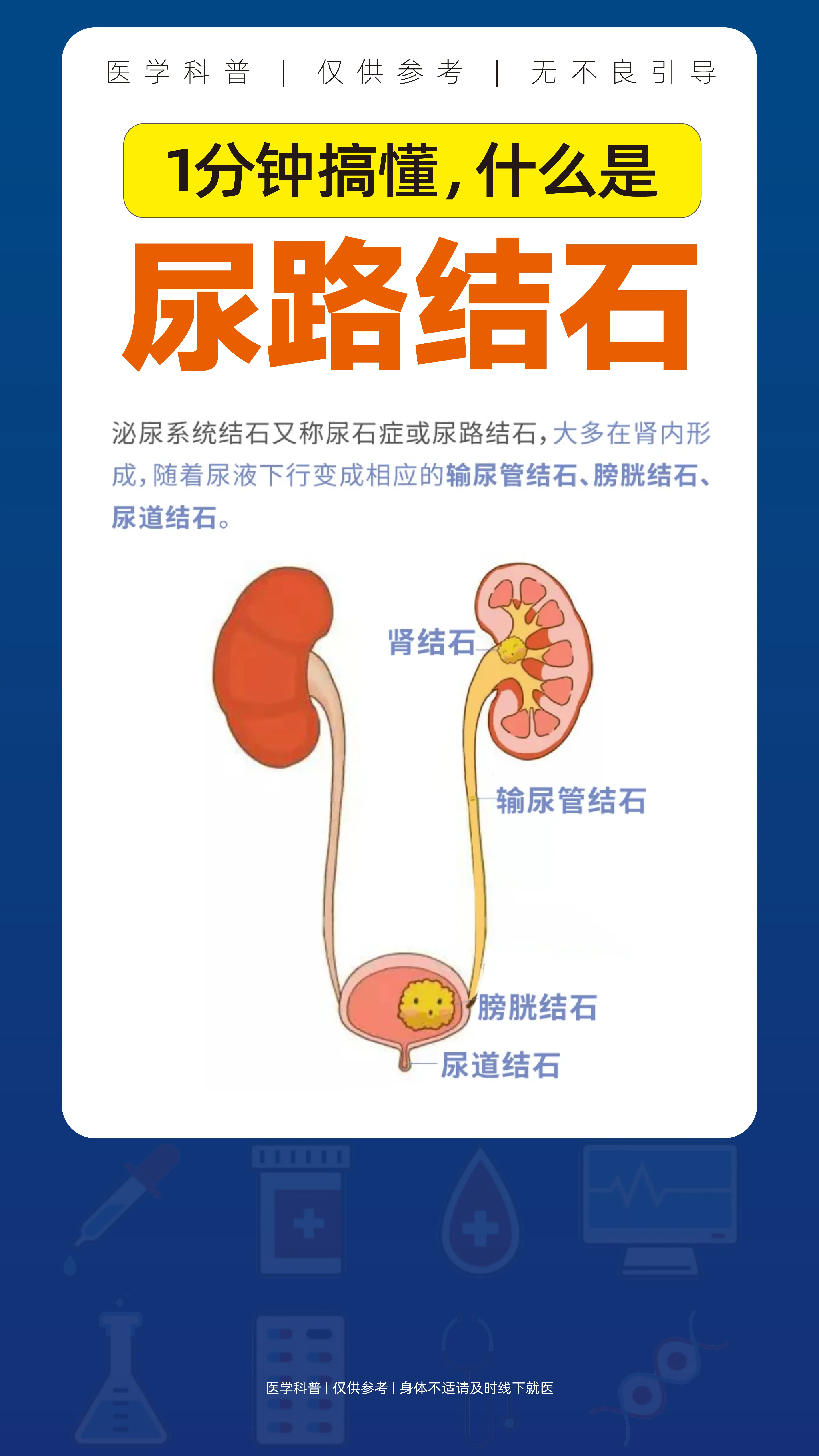 一分钟搞懂什么是尿路结石