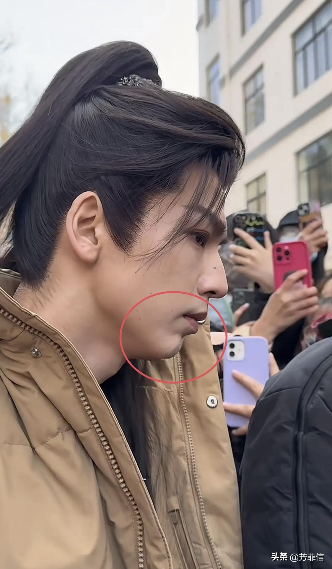 一代神颜有一代神颜的缺陷，比起笑起来满脸褶子，张凌赫更大的问题在于凸嘴，唇下组织