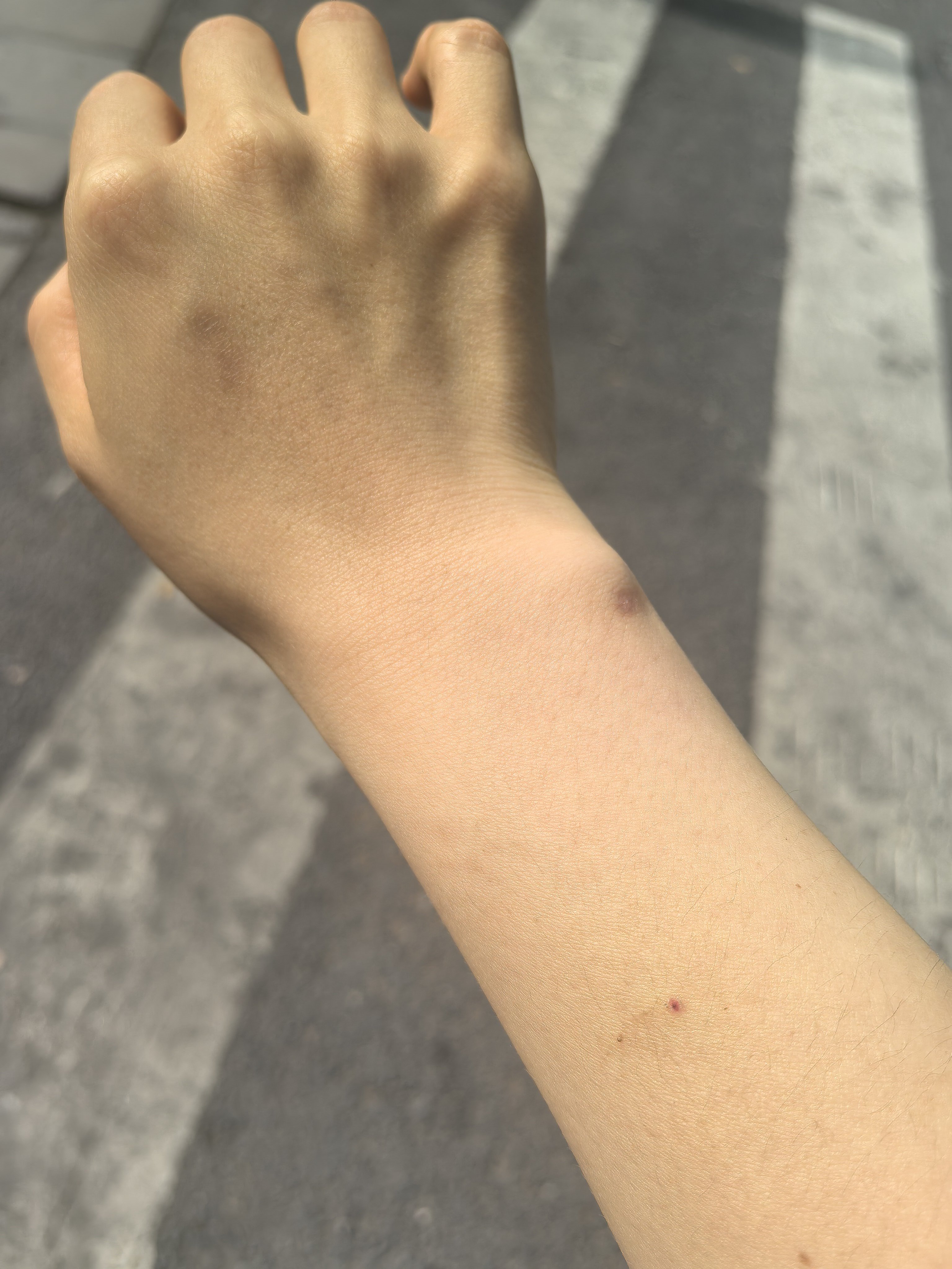 我们绿老头的外倾Se功能真的很劣势...我问了一圈我身边的infj都这样！身上永
