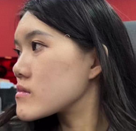 万万没想到！湖北武汉，24岁女子满心欢喜地躺上手术台，本想通过一场微调手术告别那