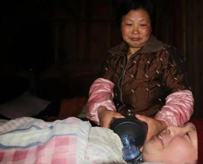 2006年，浙江一小伙因车祸永久丧失了自主呼吸功能，父母多年来捏皮球5000万次