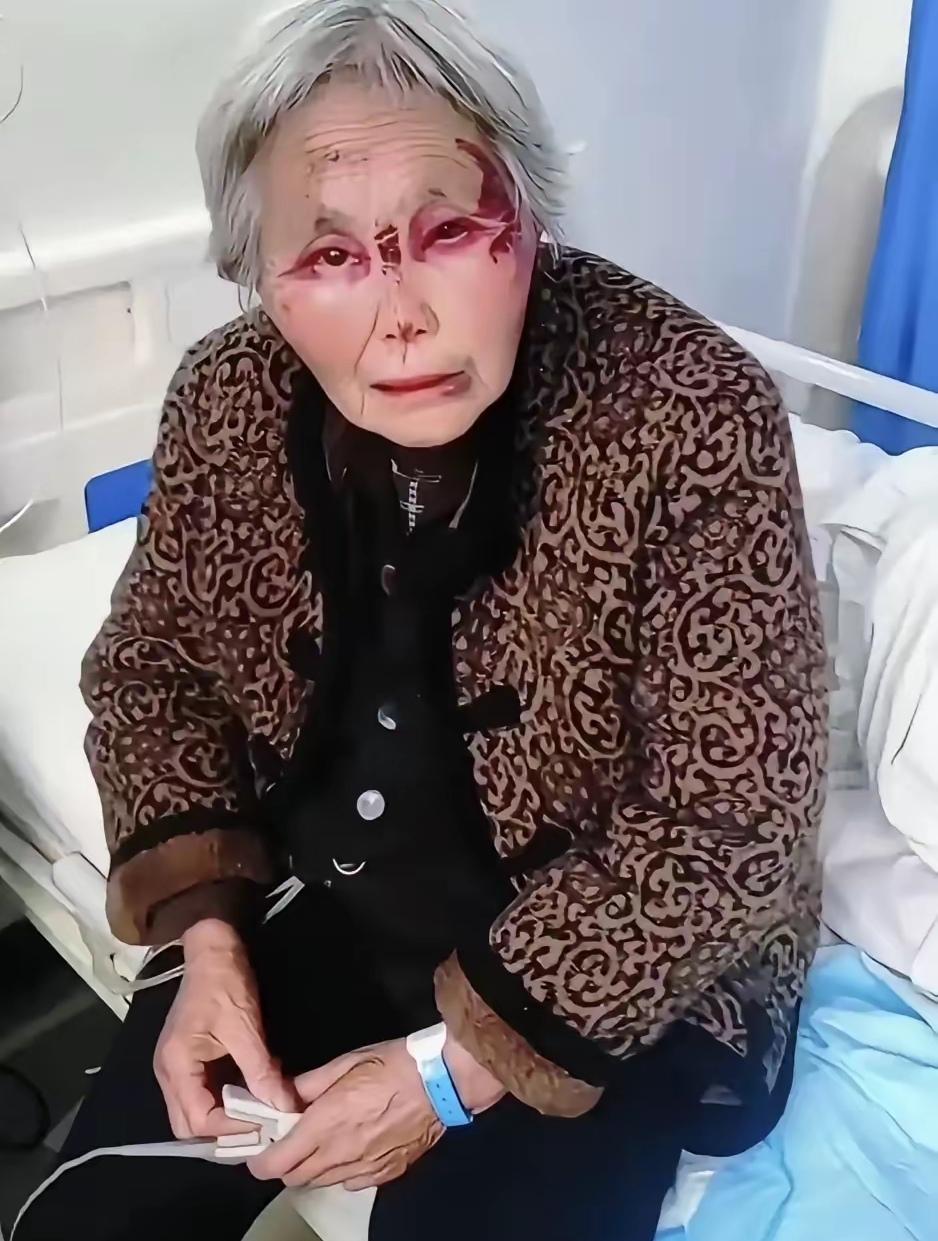 你能想象吗？一辈子育有4个女儿、1个儿子的常州老太，晚年没享到一点福，反而被儿子