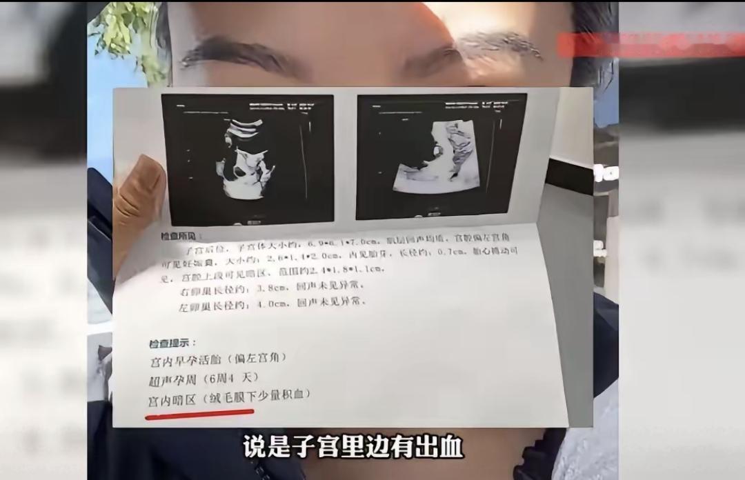 近日北京有位怀孕妇女因为天冷在家用电热毯，结果肚子疼去医院检查，医生说再继续用可