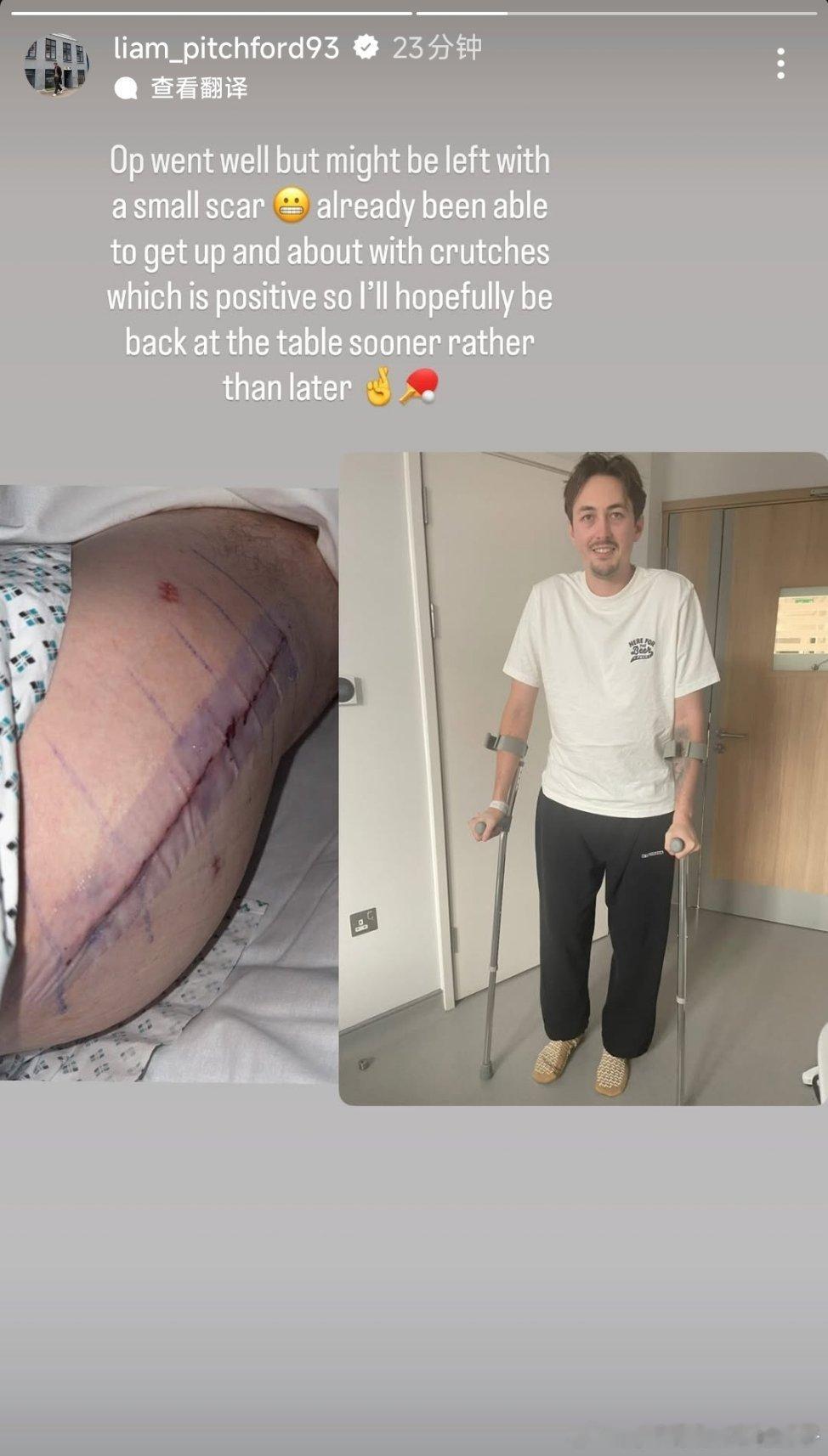 皮切福德：（髋关节置换）手术很顺利，但可能会留下一道小伤疤😢不过我已经能用拐杖