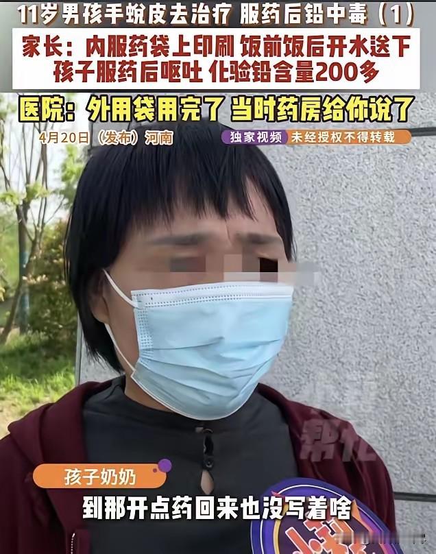 太粗心？河南，11岁男孩手蜕皮去医院看了后，开了药，回家吃完开始呕吐，送医院一查