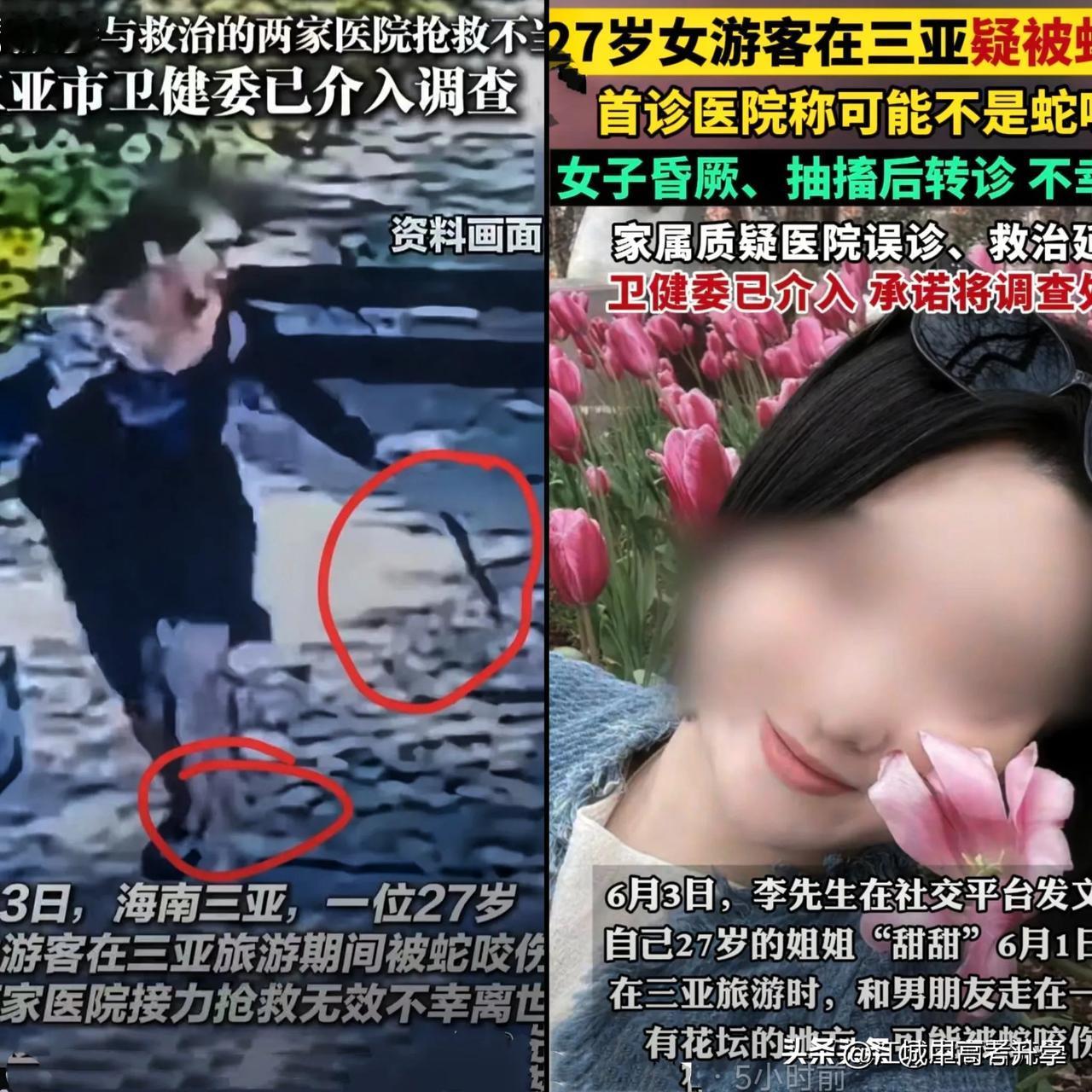 平时多学点急救知识真的可以救命，
三亚的女游客就是因为被蛇咬了选错了医院，
导致