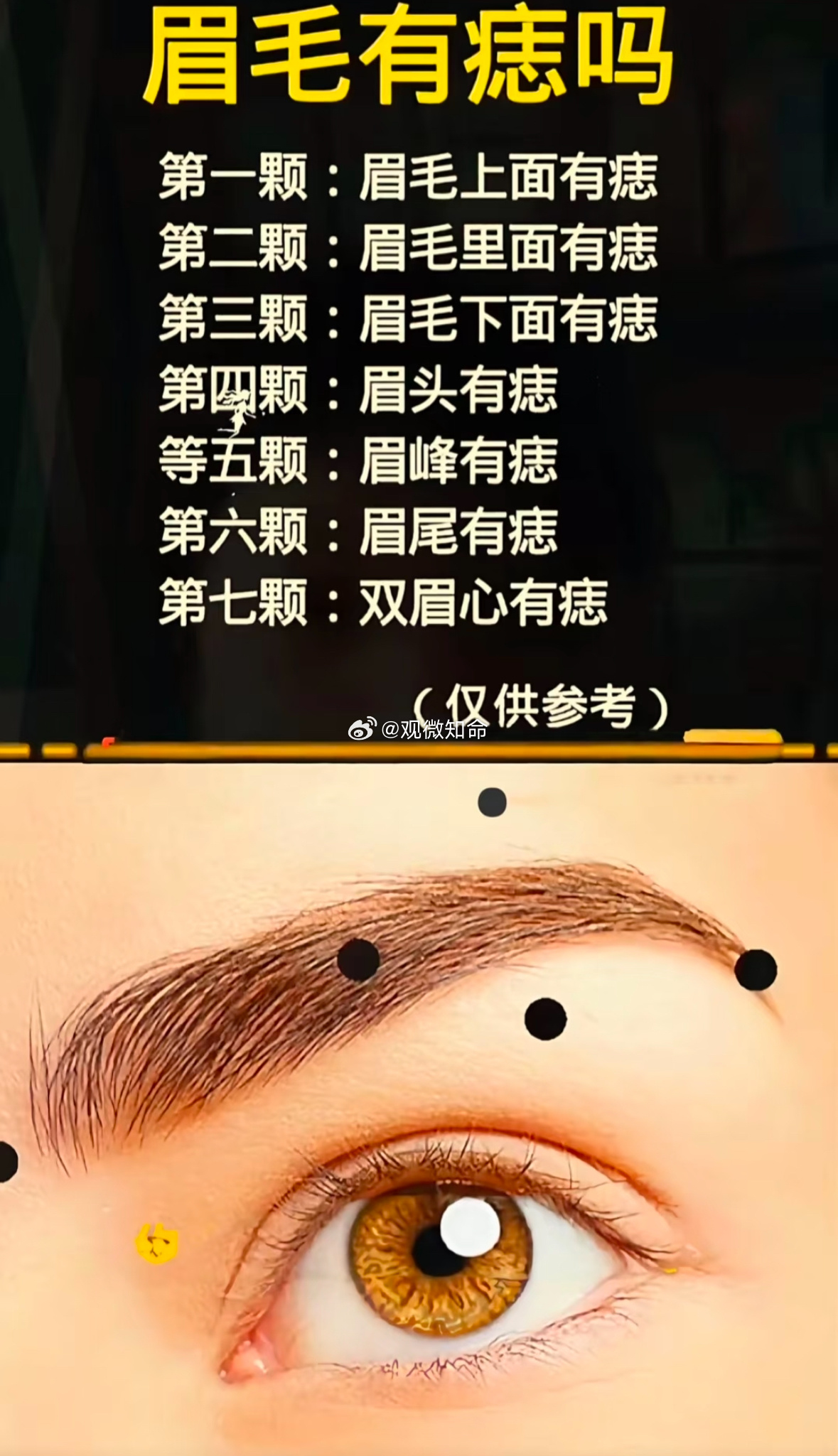 眉眼周遭对应田宅宫、福德宫，痣位暗藏缘分与福运🍃1. 眉毛里藏痣：眉里藏珠，财