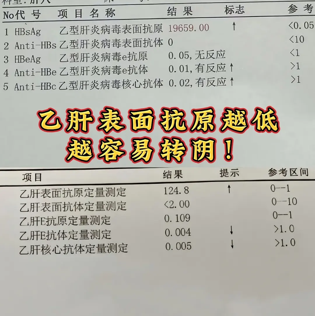 ①乙肝表面抗原1500以下：好转概率5%~15% ②乙肝表面抗原200...