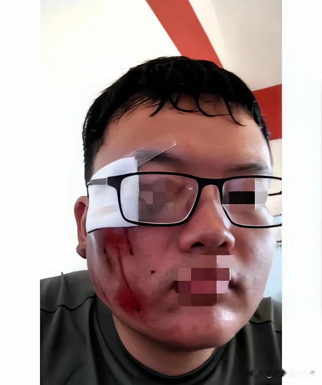 他拒绝了1000块封口费，坚持罚了对方2000，几天后，他躺在地上才懂：自己罚人