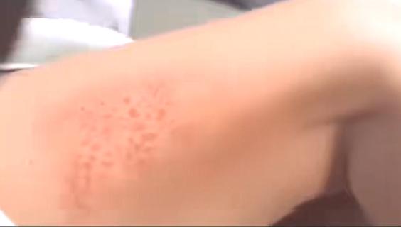 真是让人毛骨悚然啊
美国人容易过敏，背后的可怕真相！
你发现一个现象没有？美国人