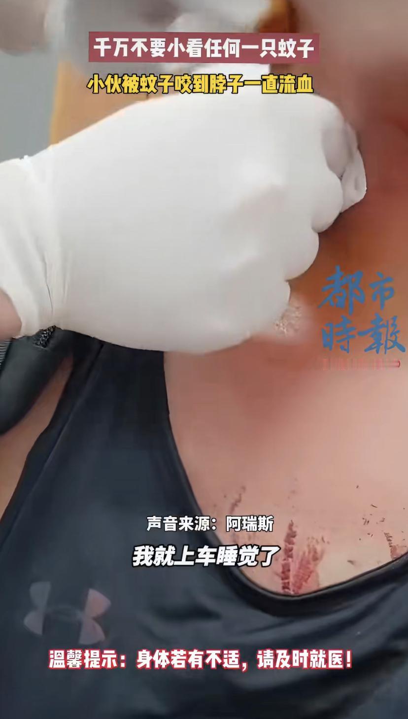 蚊子叮一下竟进医院?男子脖子血流不止，出租车秒变救护车!
上海一哥们儿最近可摊上