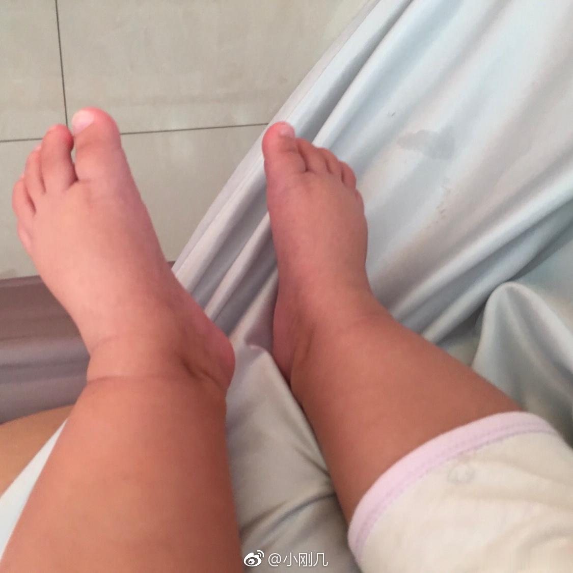 喝了藿香正气液好多了就是有一个鼻孔总是自己流出来清澈的鼻涕好像阿呆感觉是最近吐槽