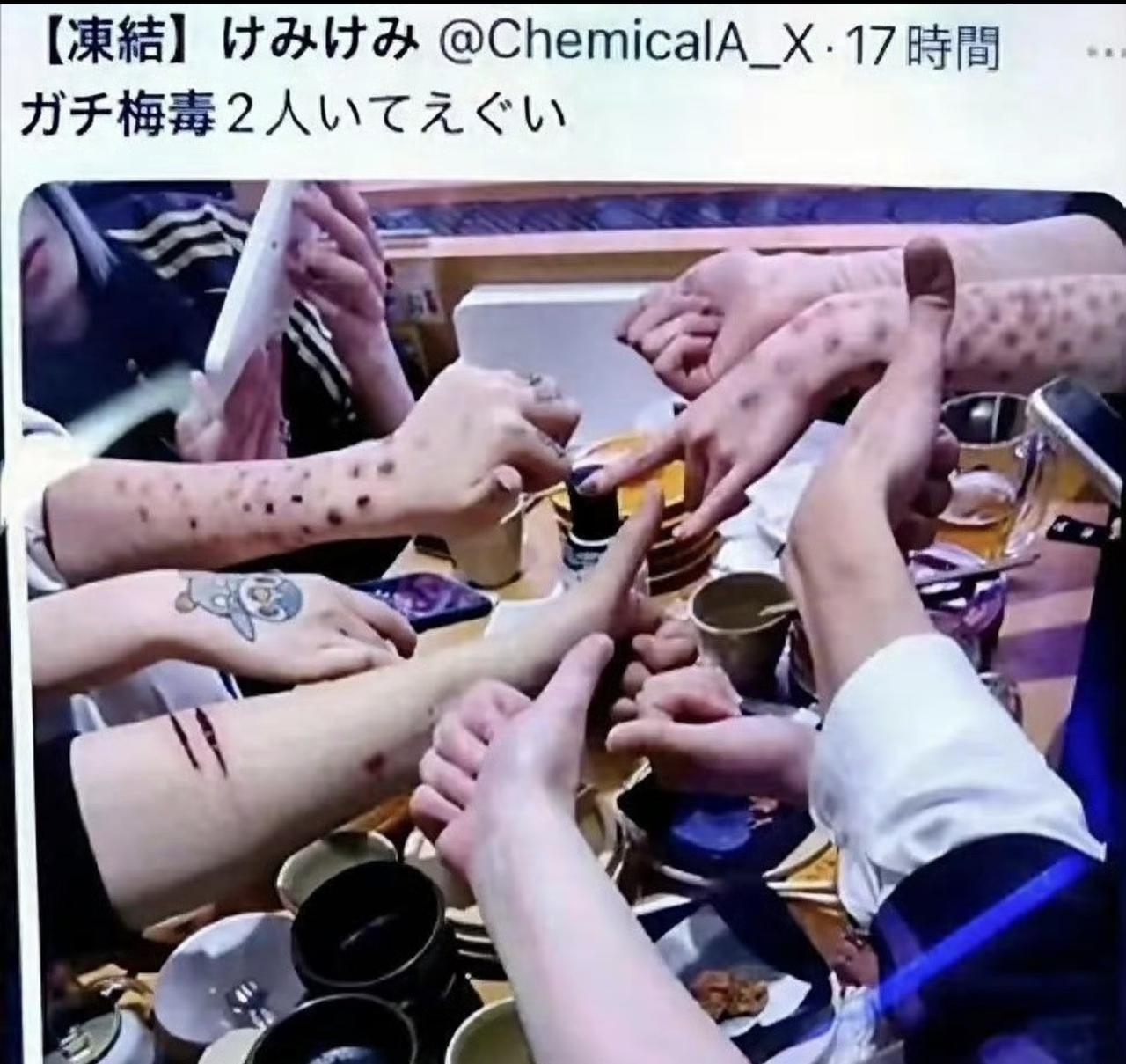 日本怎么回事儿，现在年轻人得梅毒数量飙升不说，居然还不以为耻，反以为荣！

居然