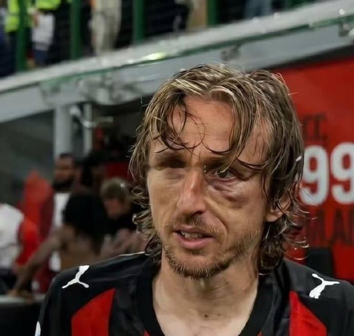 悲喜交织💔✨皇马中场传奇莫德里奇遭遇颧骨重伤，已完成手术，确定赛季提前报销，无