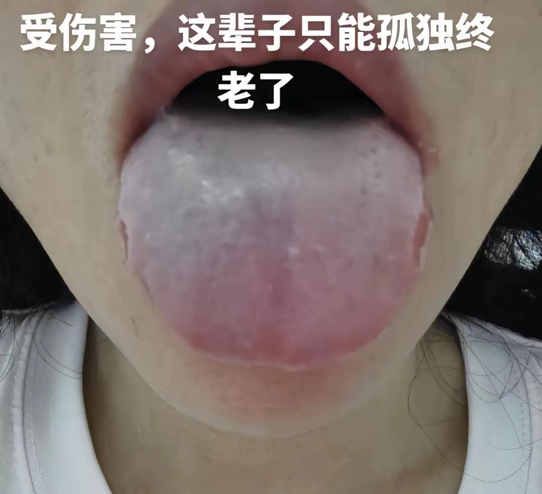 美女才30岁，遇到过渣男，整了一身毛病[尬笑]
患者自述：浑身酸痛，睡觉不解乏，