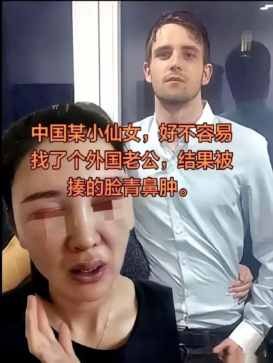 这个当年不要彩礼也要嫁给外国人的小仙女，如今鼻青眼肿的来分享国外生活，从十指不沾