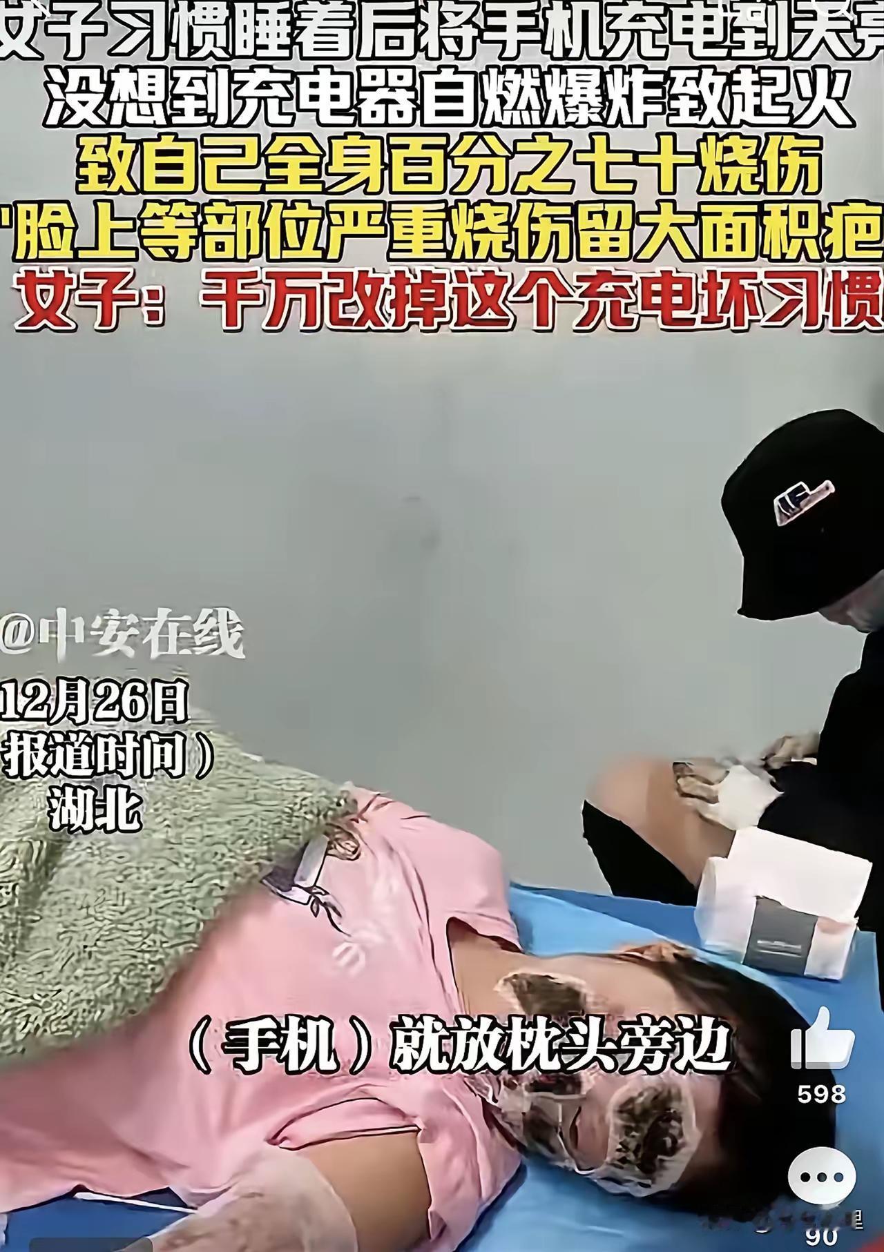 湖北一位女子，就因为睡前把手机插上充电，结果半夜充电器突然自燃爆炸，导致她全身7