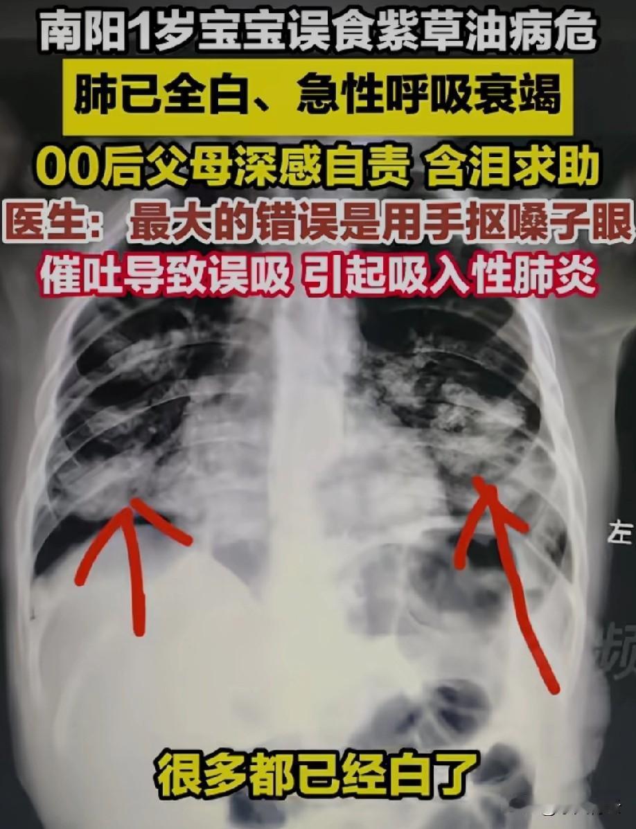 大人还是要小心些
像这样的东西应该另放
收藏起来