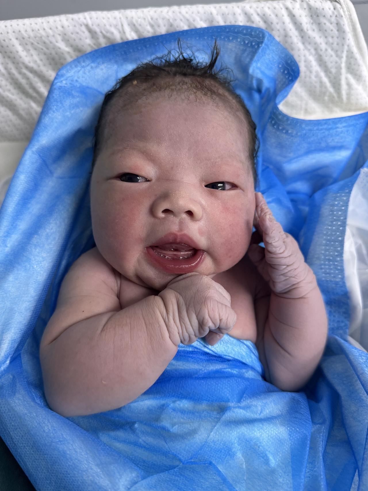 待产3天
顺转剖 2950克女宝🎉