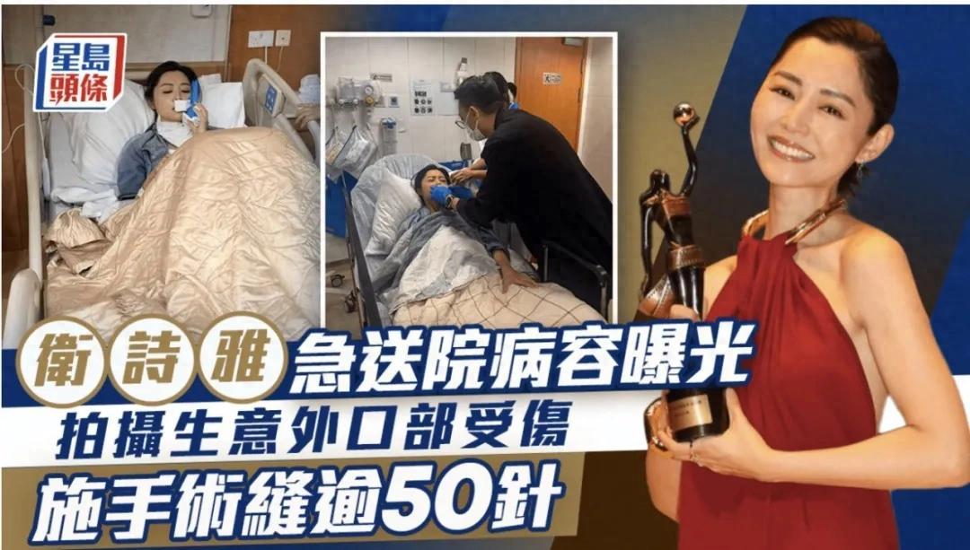50多针！全缝在脸上！

 我的妈呀，光听着都倒吸一口凉气！一个女演员卫诗雅，脸