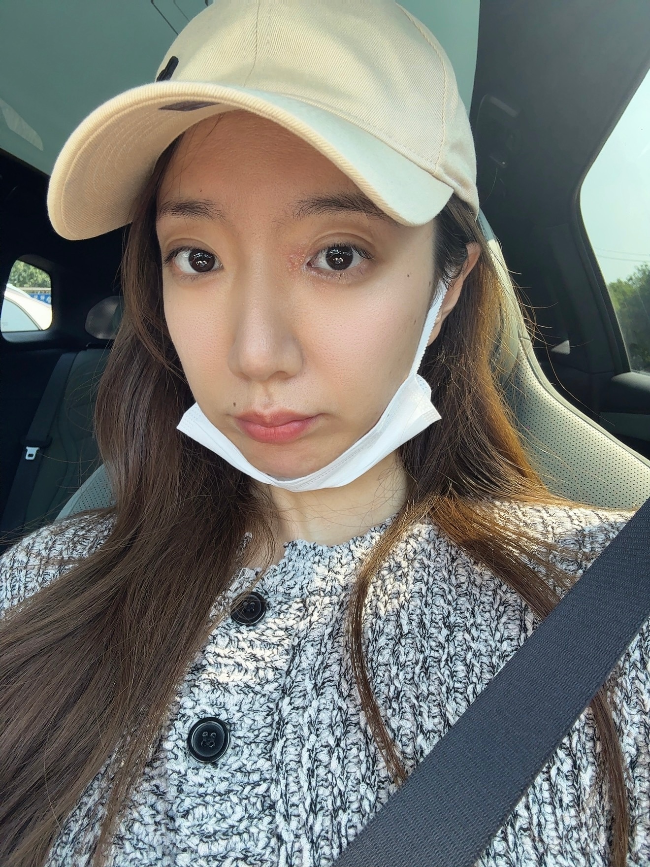 我居然长针眼了[淡淡的][淡淡的]下周要拍五个视频咱也不知道这两天能不能好的了 