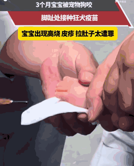 防不胜防！浙江，一个才3个月的宝宝正乖乖喝奶，被邻居突然冲过来的狗一口咬住脚趾！