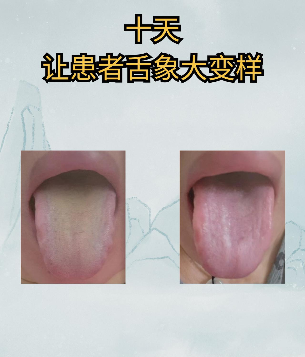 老中医只用了1招，10天时间，让患者气血亏虚，湿热重的问题有了大改善#中医##养