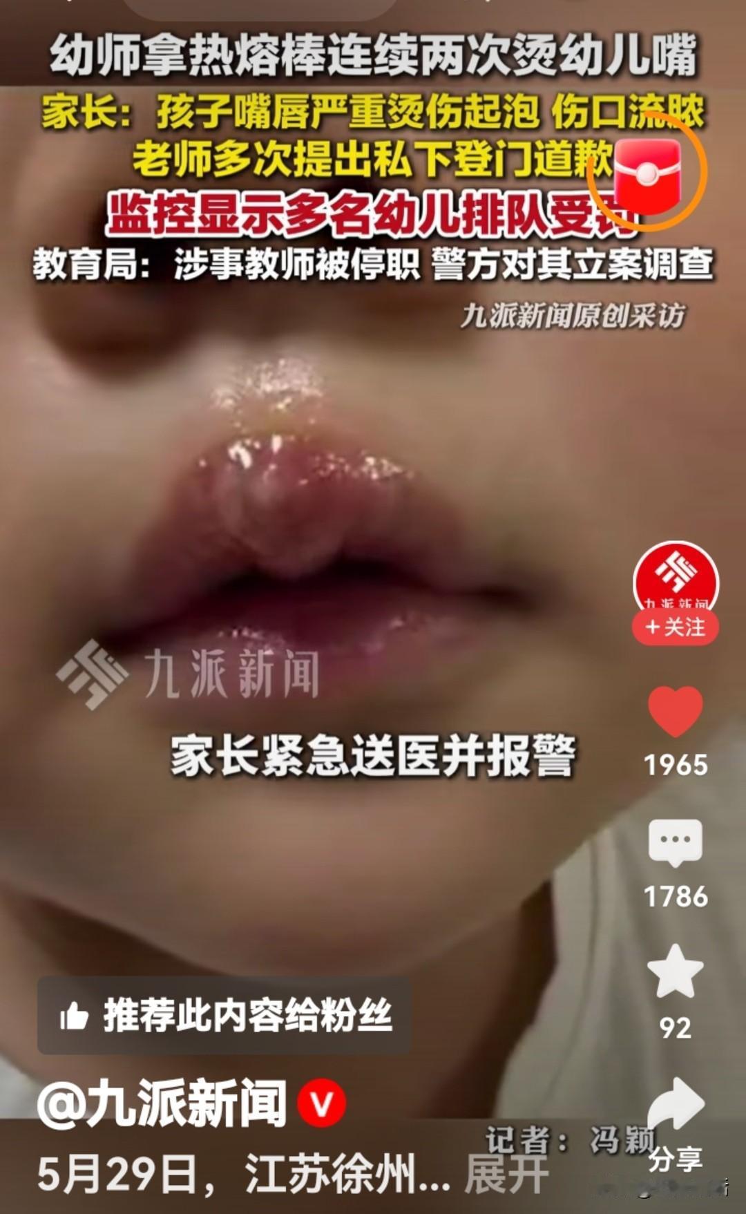 如果不是有江苏丰县教育局的通报为证，我不敢相信下面图片中女孩嘴唇上的伤口是教师体