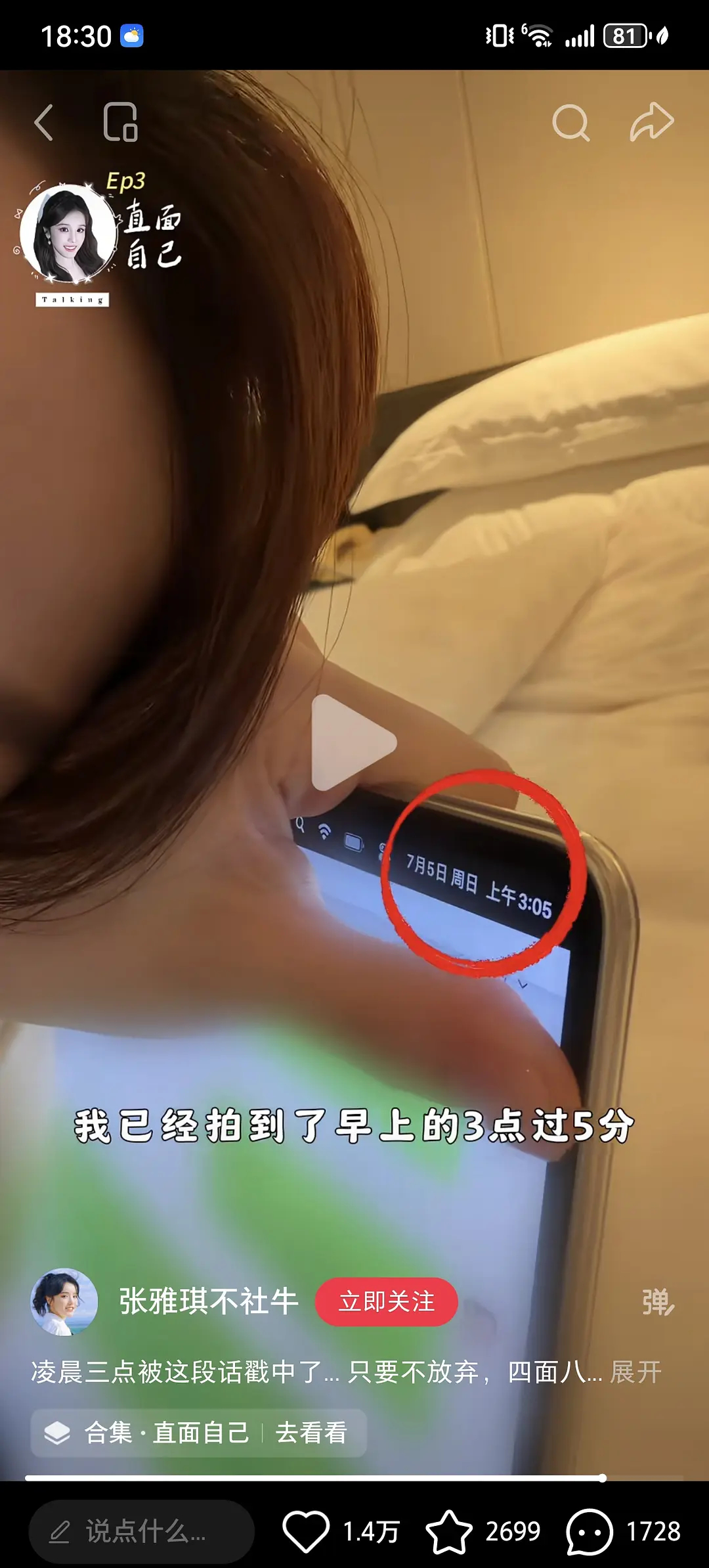 中餐厅录完一个多月了为什么张雅琪还要穿着厨师服录vlog？ 