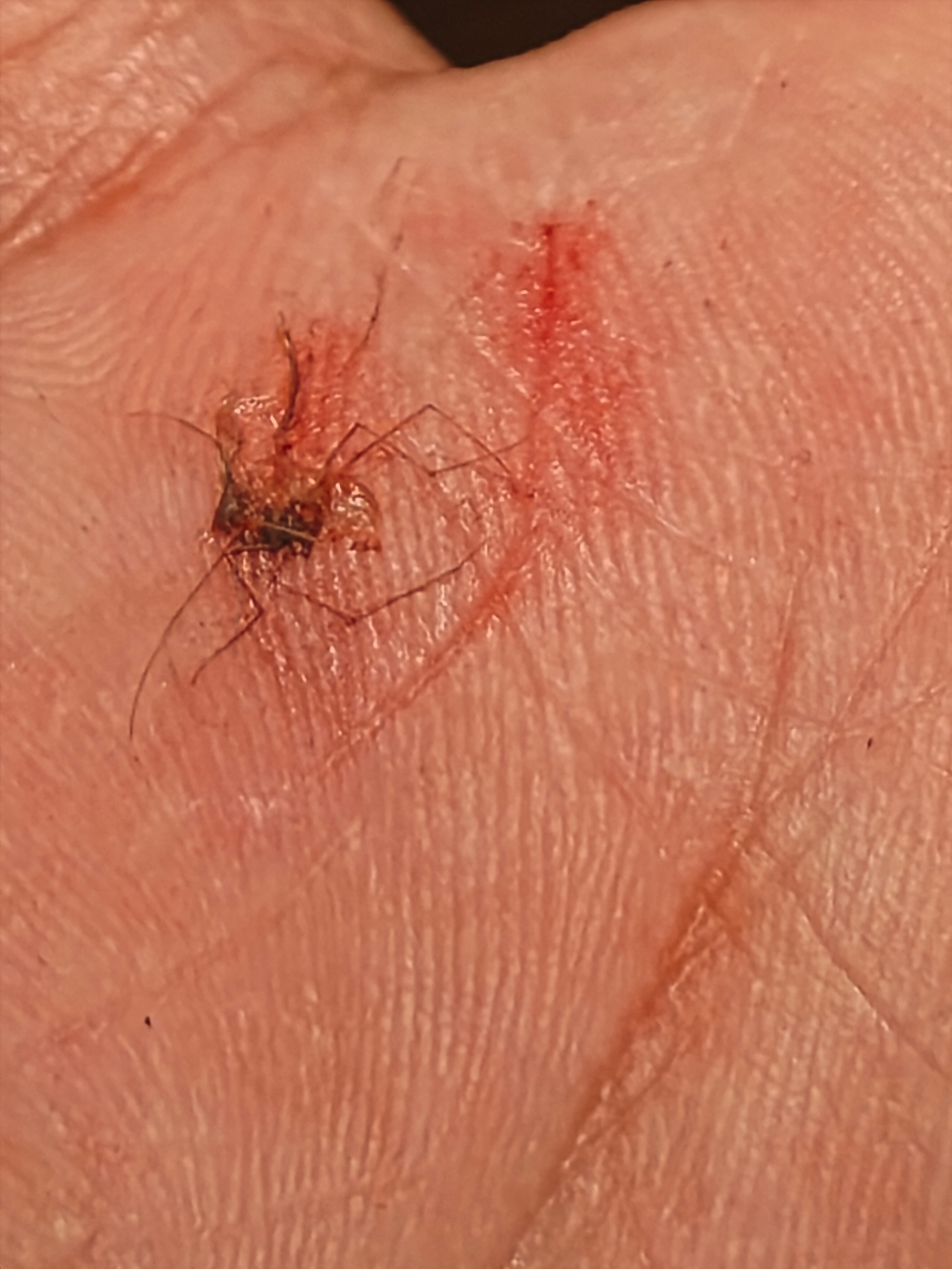 这么冷的天居然还有蚊子。。。刚咬了我屁股没打死，又跑我额头上来了。 ​​​
