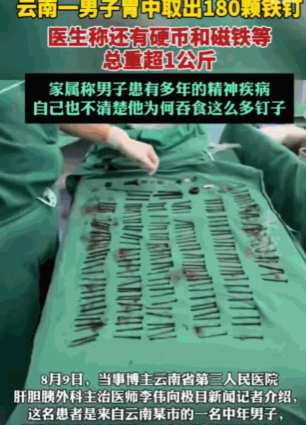解释不清了！云南，一男子腹部剧痛送医，医生检查后当场被吓退三分：他体内居然塞满了
