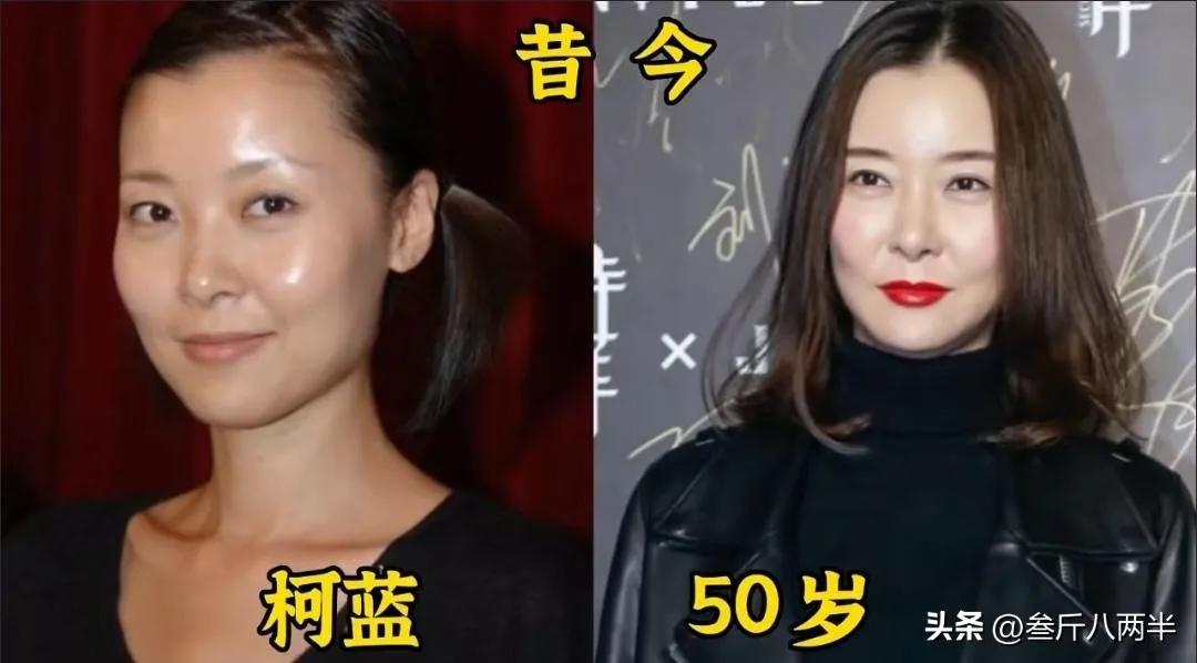 郝蕾年轻时候紧致细腻的肌肤，透着更加甜美与灵动的气息，让整个人的姿态都变的更加可