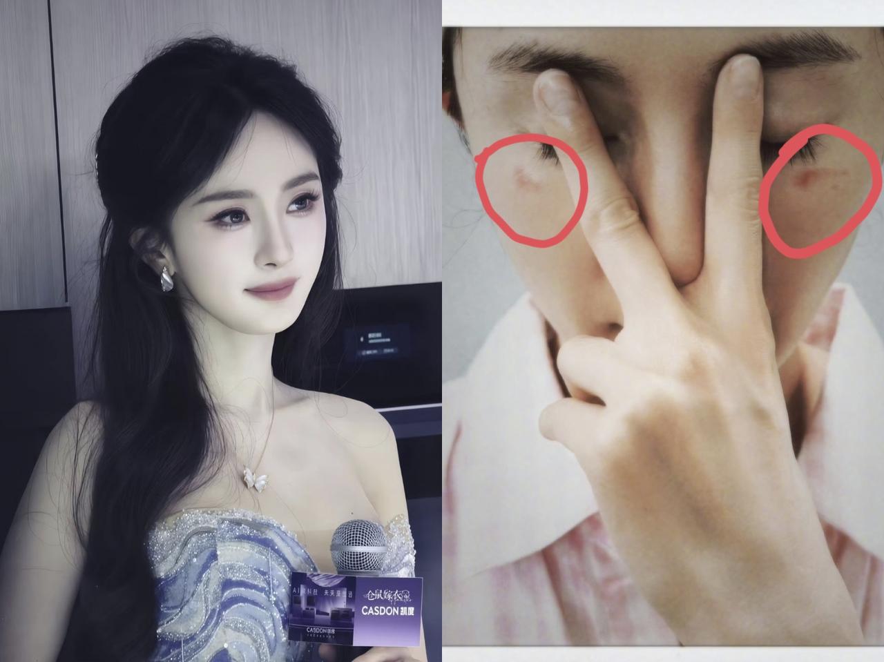 天呐，第一次知道蒸汽眼罩这么危险！
就在刚刚，
杨幂发文“蒸汽眼罩咬人”，两个眼