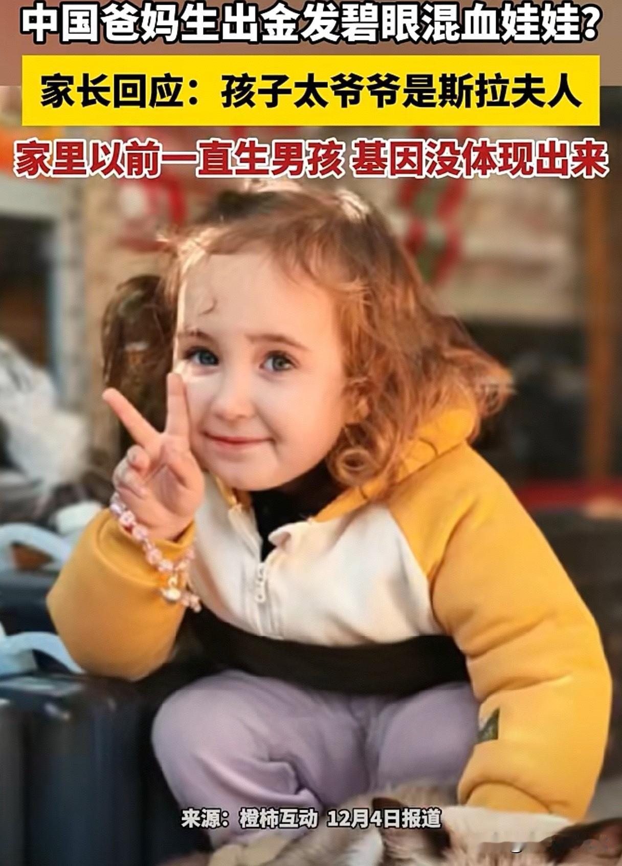 有点意外有点神奇了！中国爸妈生出金发碧眼混血娃娃？家长回应：亲生的。

近日，江