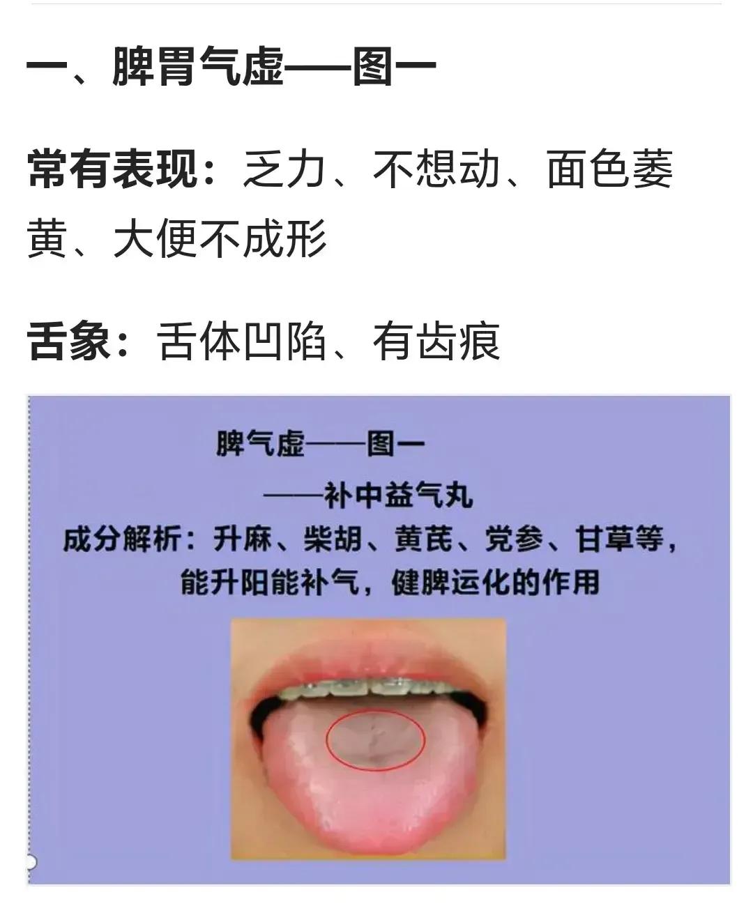 你是不是经常感到湿气重、脾胃虚、气血差、腹胀腹泻？别担心，今天我来分享9味中成药
