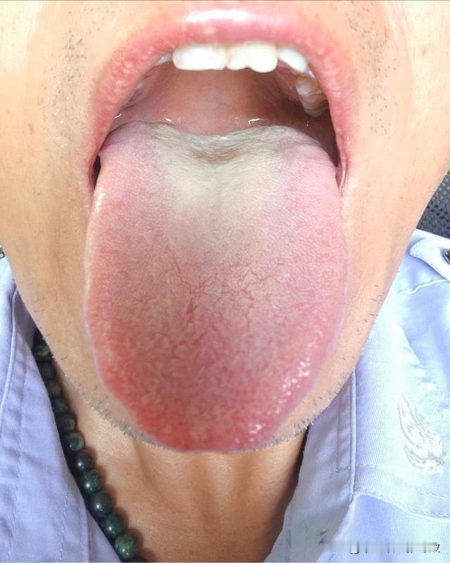 这大哥才刚过40岁，就发消息说不行了，一到晚上就害怕[捂脸][捂脸][捂脸]
主