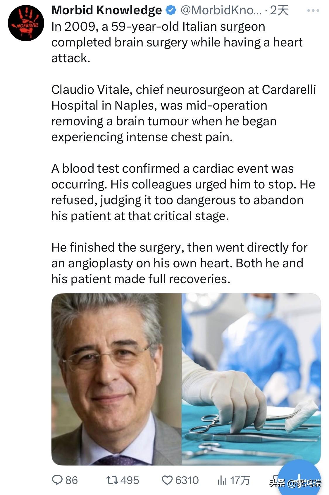 2009年，一位59岁的意大利外科医生在心脏病发作的同时完成了脑部手术。

那不