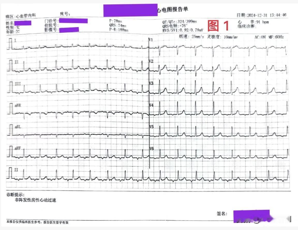 37岁女性患者，因“反复发作胸闷、憋气、乏力”看过多家医院，心脏彩超未见明显异常