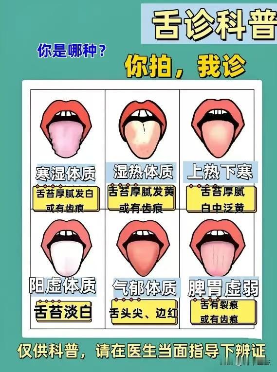 应粉丝要求，挑战一天看66个舌象，你拍舌头，我分析，现场告知结果！

快来评论区