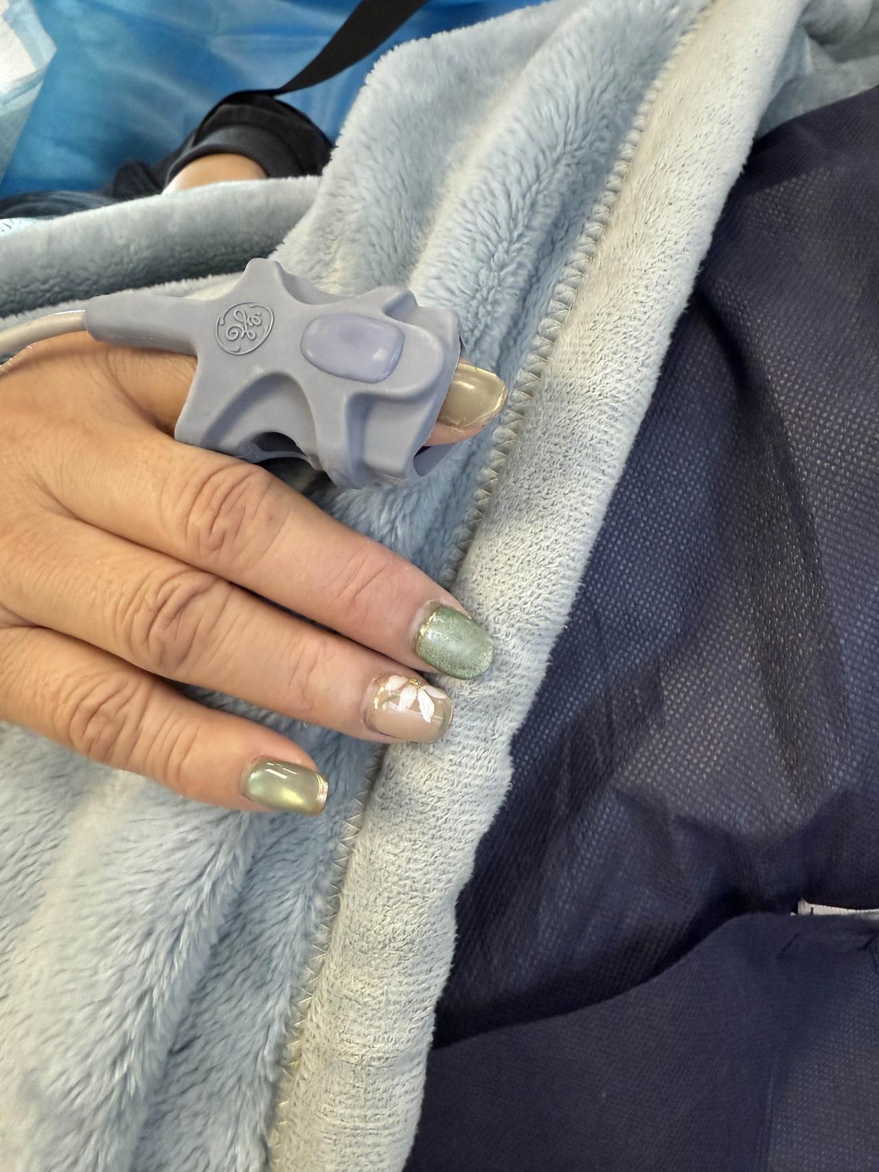 友情提醒：做麻醉胃肠镜不要涂非常厚的美甲。
颜色越鲜艳，涂得越厚，它越容易影响麻